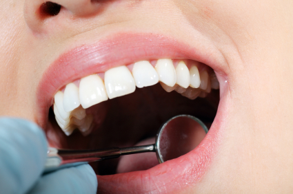 The Impact of Oral Conditions on Life