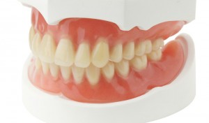 Acrylic dentures look like real teeth and gums.